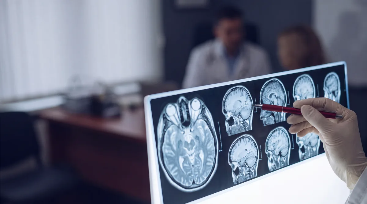 Gloved hand with a crimson pen reviewing brain MRI scans on a backlit medical lightbox